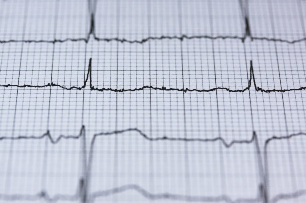 a normal heart rate reading, representing the benefits documentation writers can provide to the healthcare industry